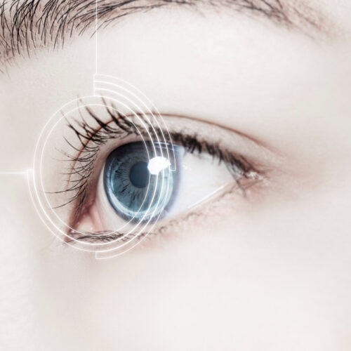 3 things about cataract surgery that you are curious about from a Korean eye doctor!