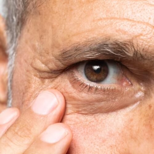 Korean Doctor’s Insight: Xerophthalmia Treatment & Dry Eye Symptoms