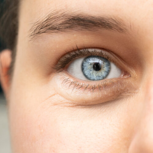 How long does lasik take? Smile Pro eye surgery in Korea