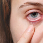 dry eye symptoms blurred vision, how long does eye surgery take , dry eye doctor near me, will dry eye cause blurred vision