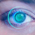 is laser eye surgery worth it, doctor in korea, lasek eye surgery recovery time, does laser eye surgery hurt, lasek surgery near me, lasek procedure